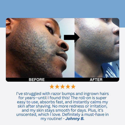 Silque™ Smoothing Solution Ingrown Hair Treatment